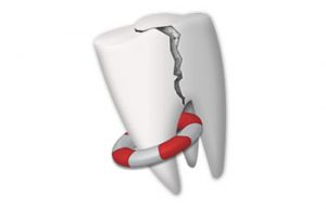 Damaged tooth on the lifebuoy