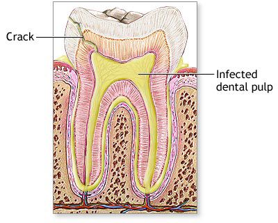 Internal cross-section of the tooth